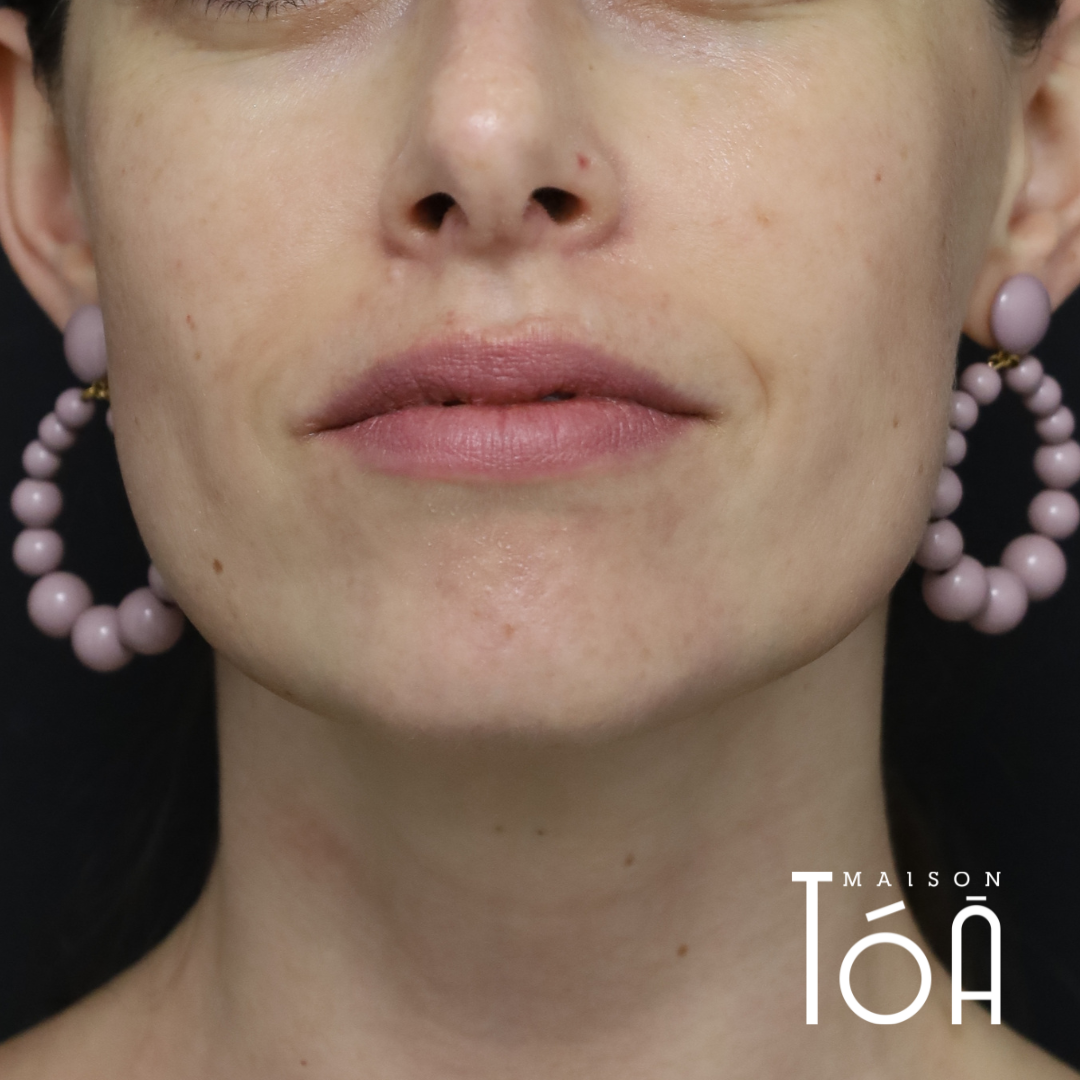 1 3