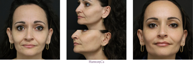 HarmonyCA