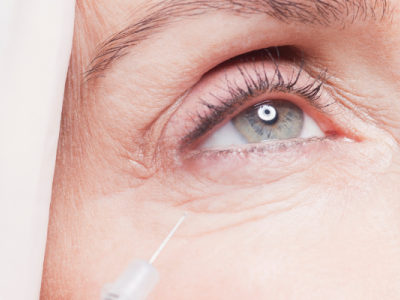 Médecine esthétique à 50 ans