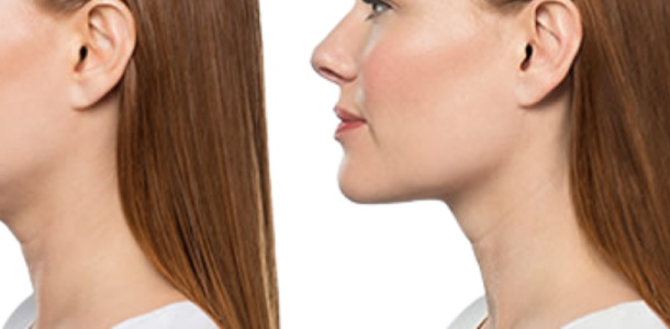 Photo site traitements 1920 x 400 11