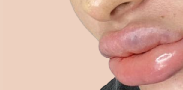 Photo site traitements 1920 x 400