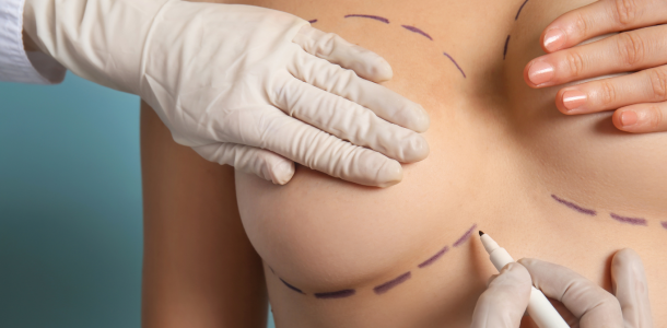 convalescence augmentation mammaire