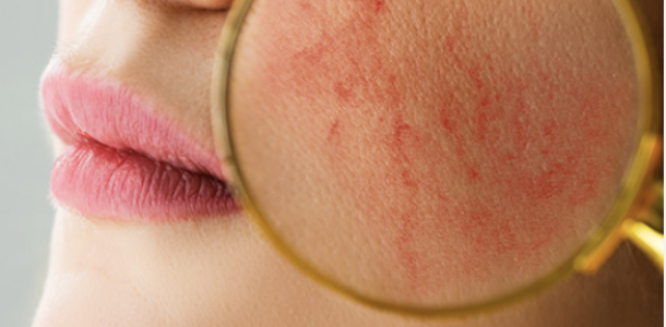 Capture decran 2024 11 10 a 17.51.54